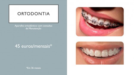 /products/ortodontia-para-todos/